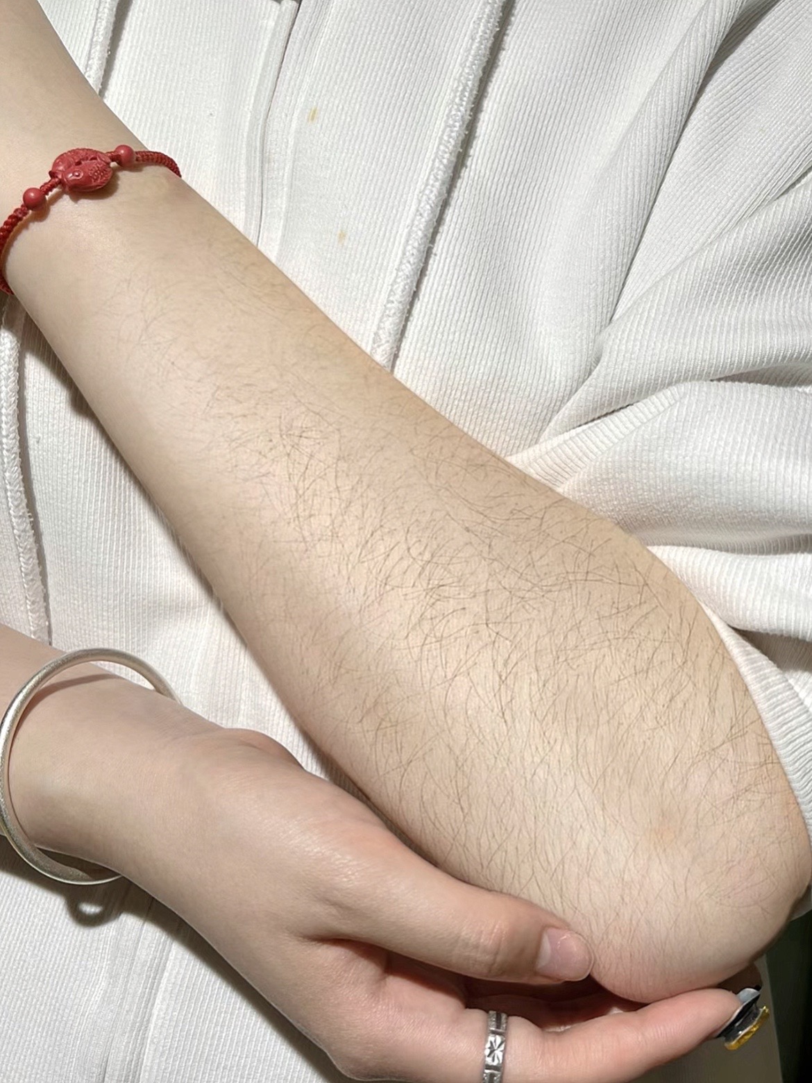 重度汗毛成功上岸!再也不用去挂皮肤科了!