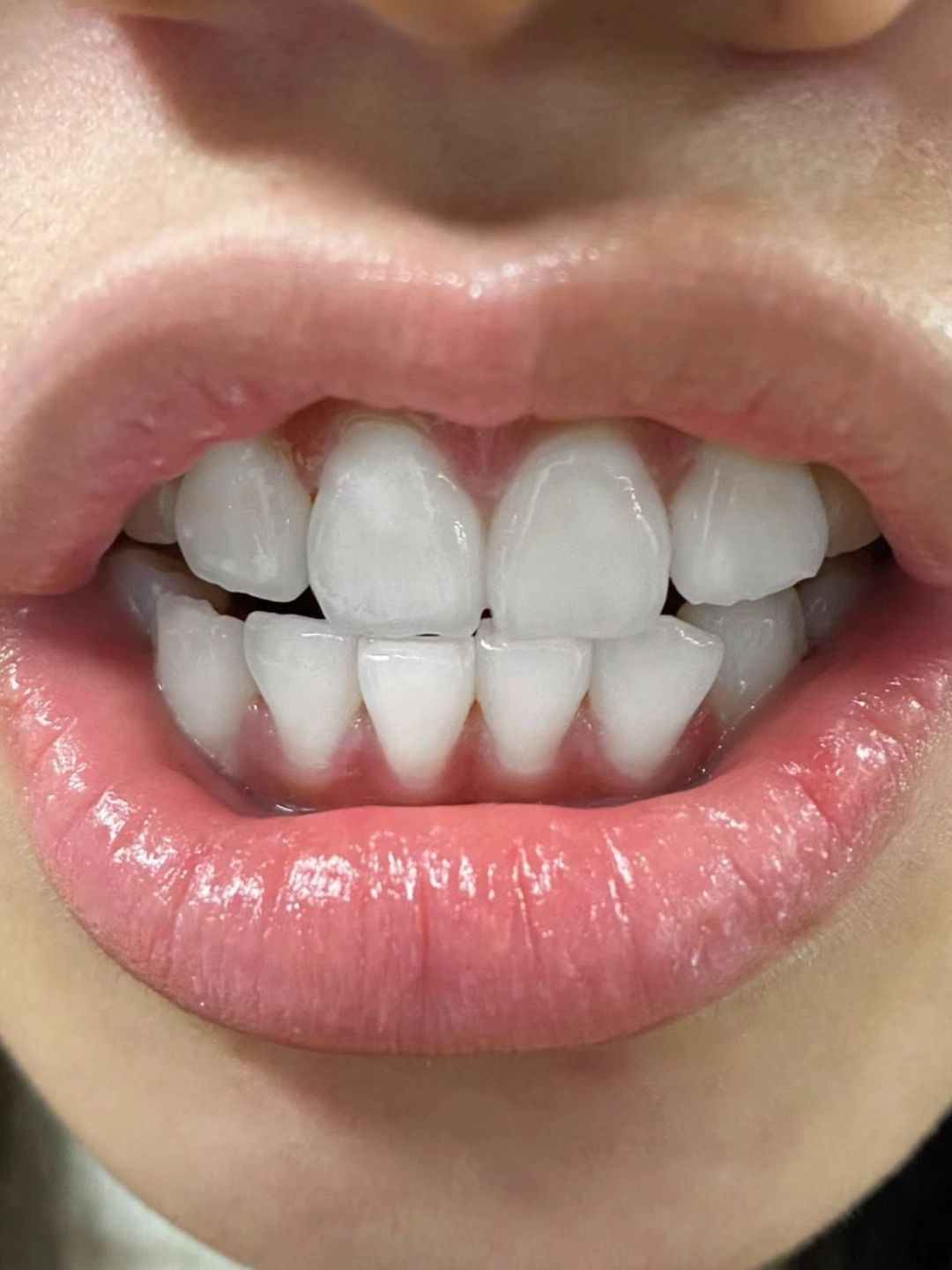 谁懂早八人的痛,太困了只能每天早上来杯咖啡
牙齿黄的化妆都不好看