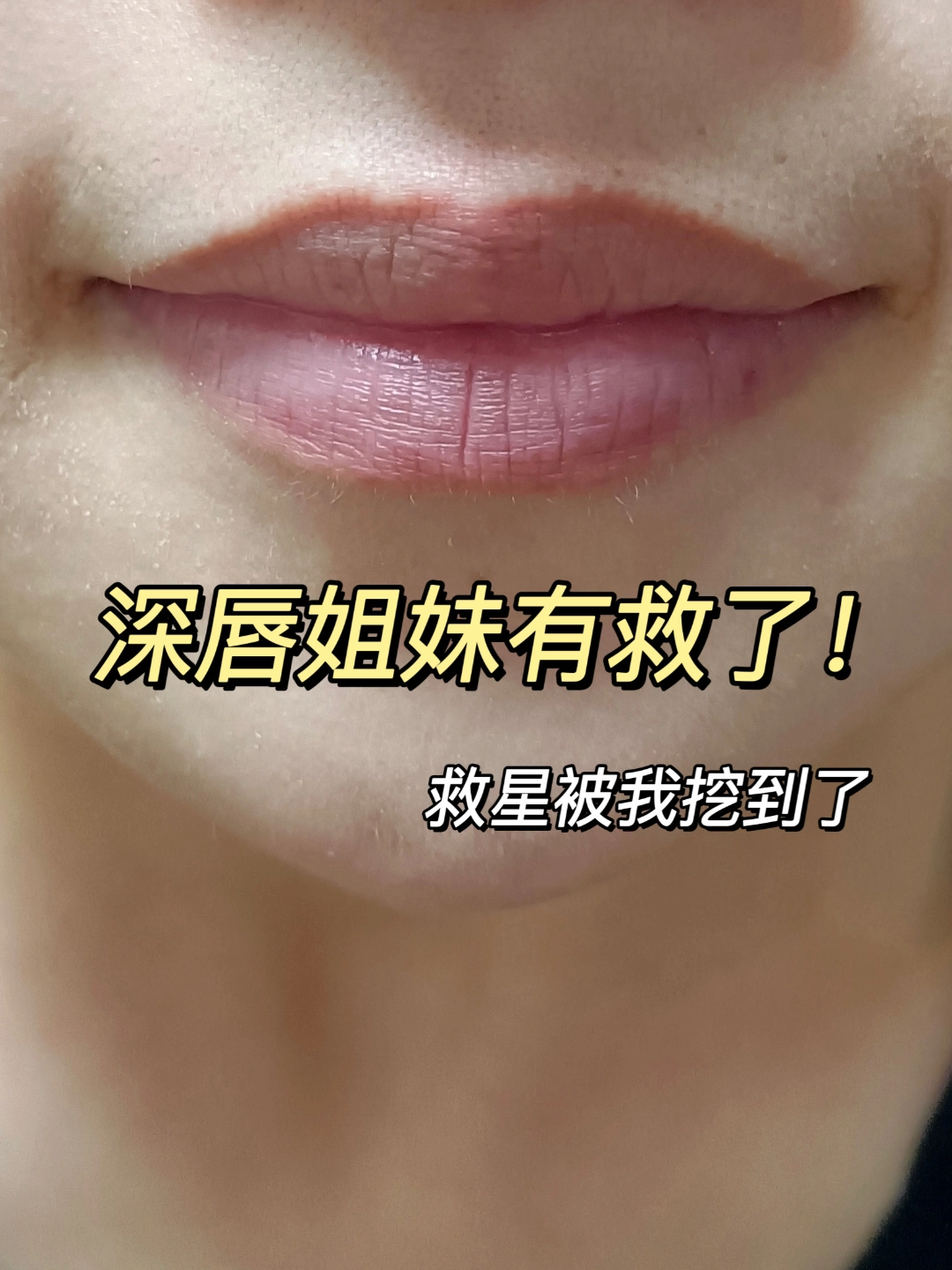 深唇唇纹深的姐妹有救啦!