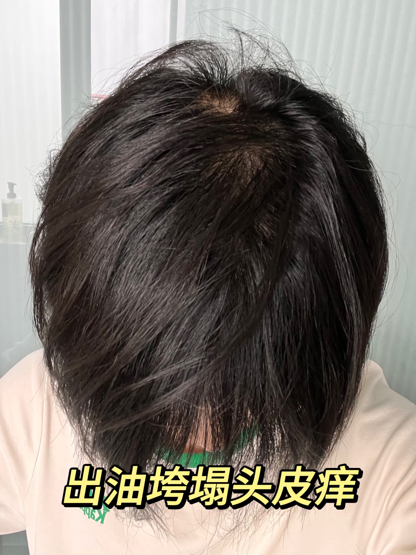 头发出油扁塌,头发油腻扁塌(第4页)_大山谷图库
