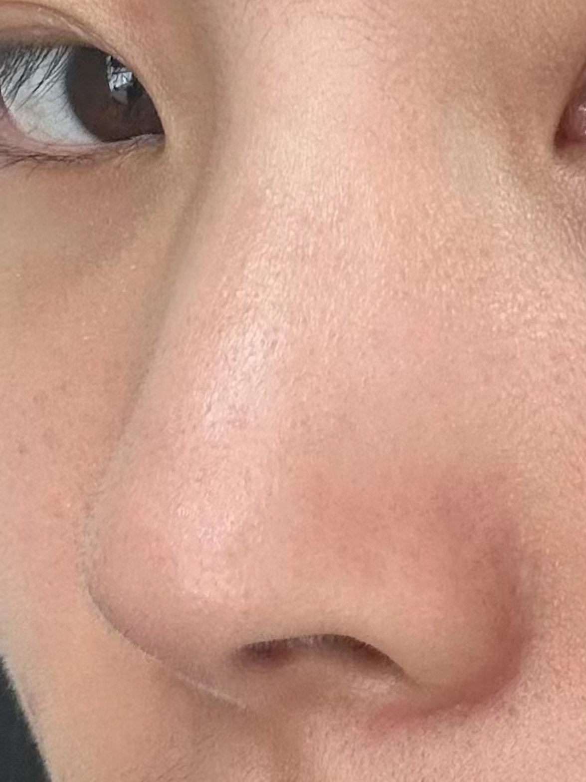 在脸上给毛孔做大扫除的感觉,谁懂!