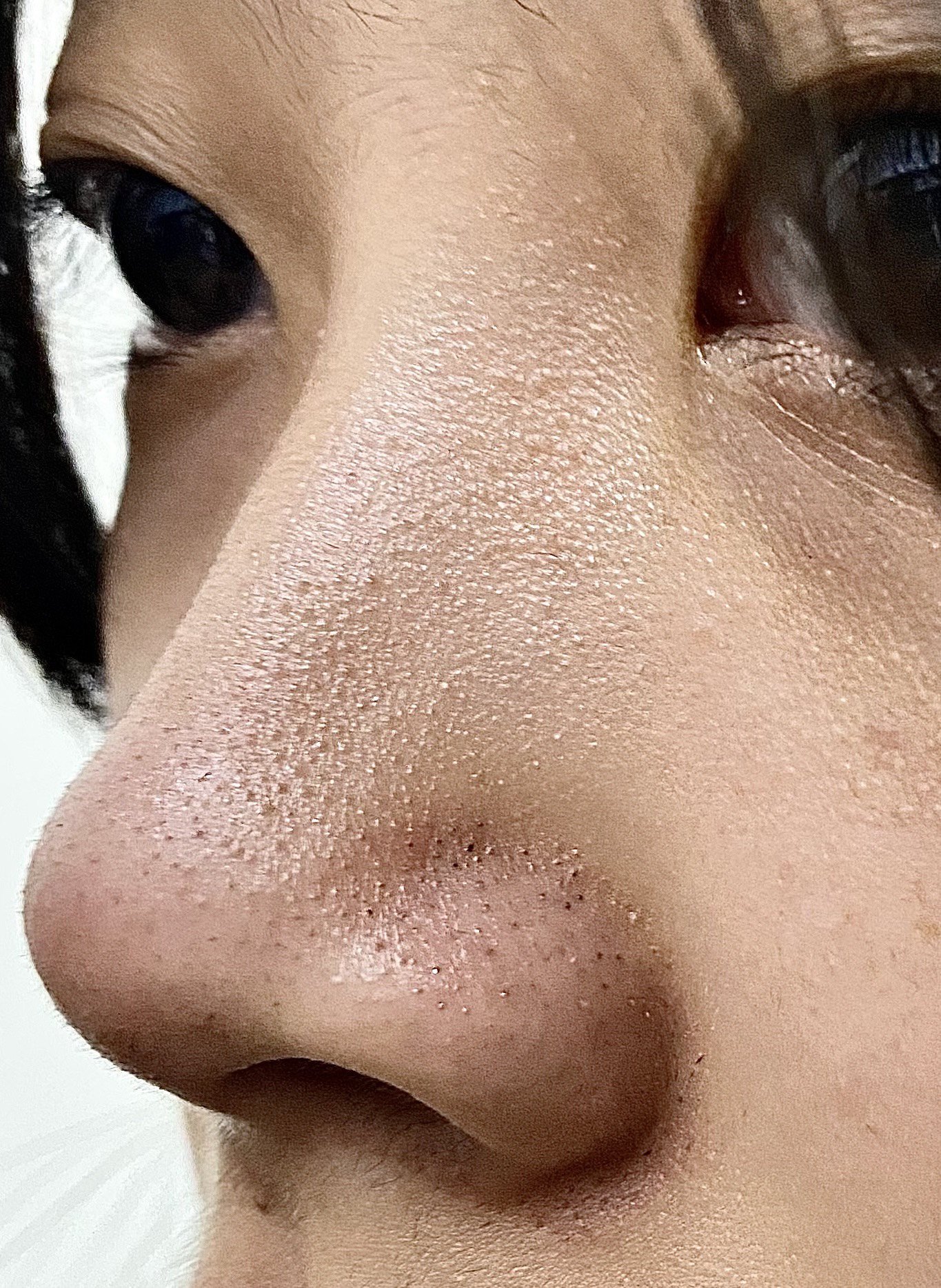 黑头白头都冒出来了!这个小东西去黑头真的好牛