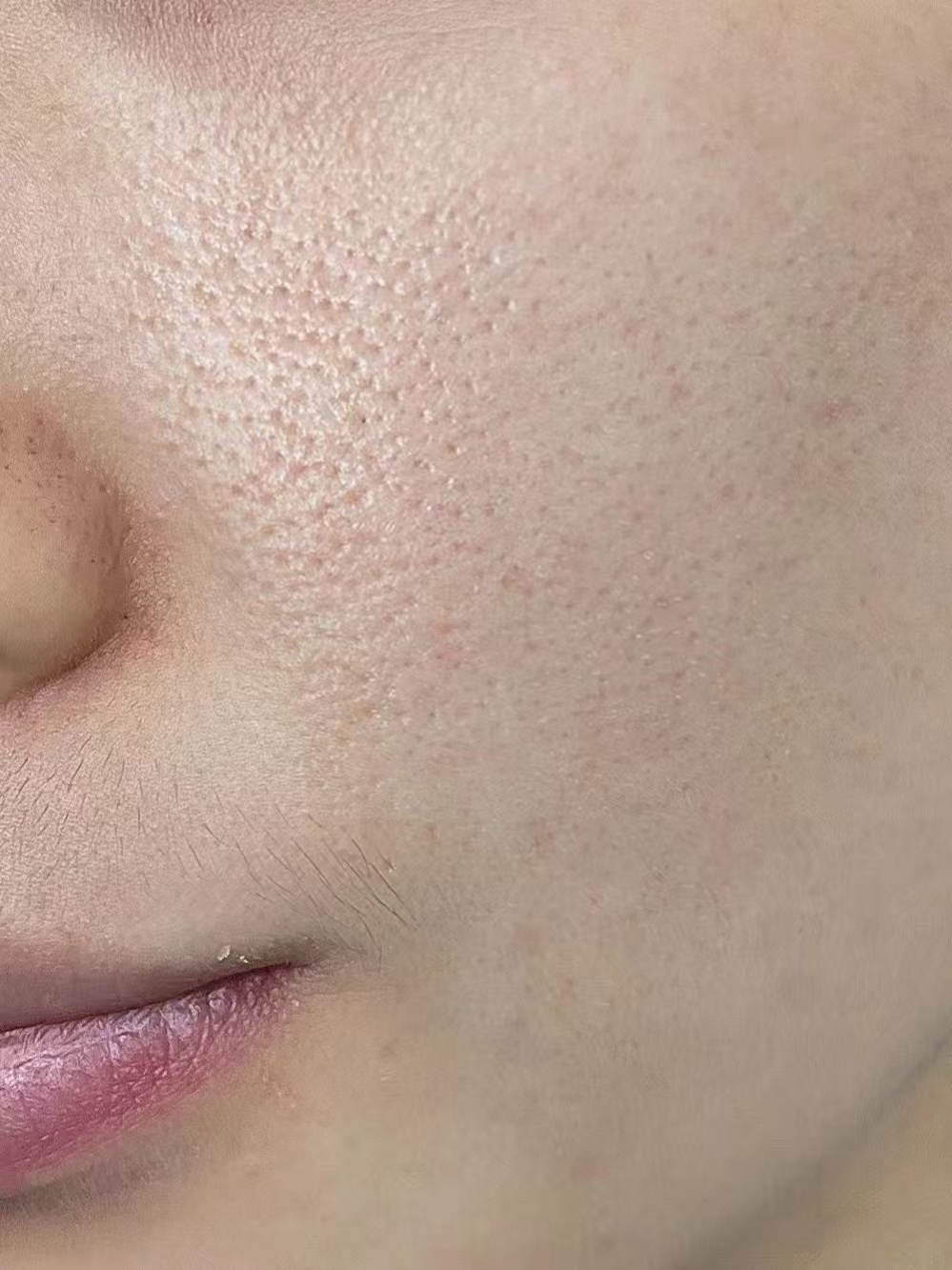 天塌了!毛孔这么大怎么过年