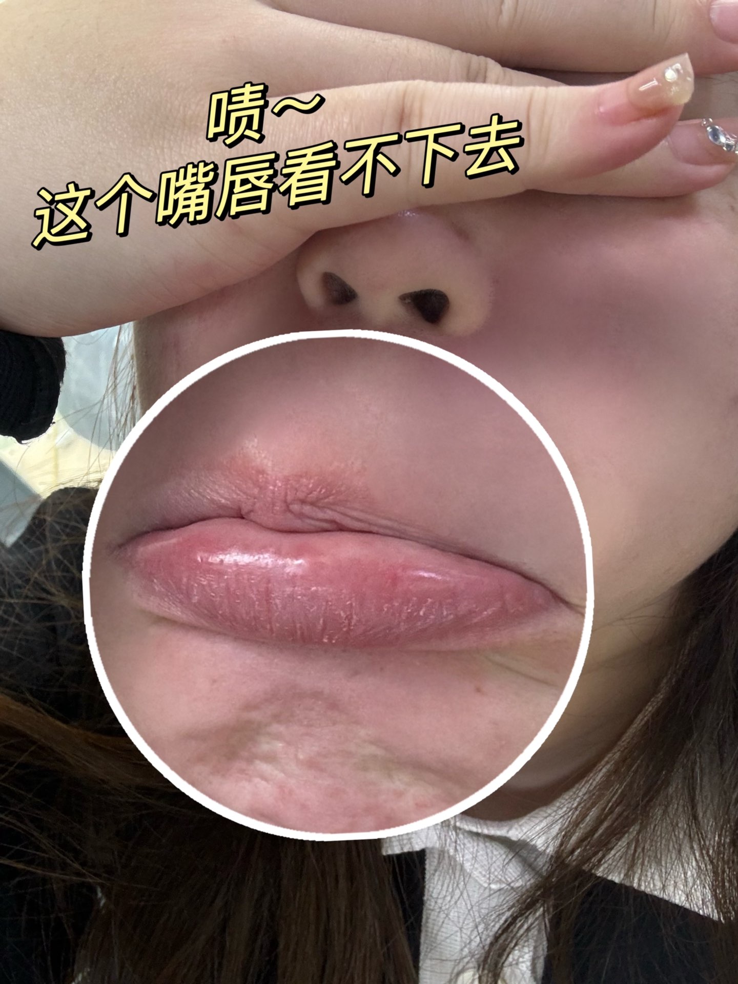 冬天嘴唇干到起皮真的丑爆了