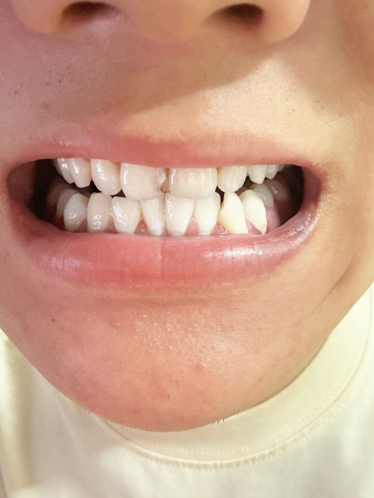 牙齿白白从它做起!