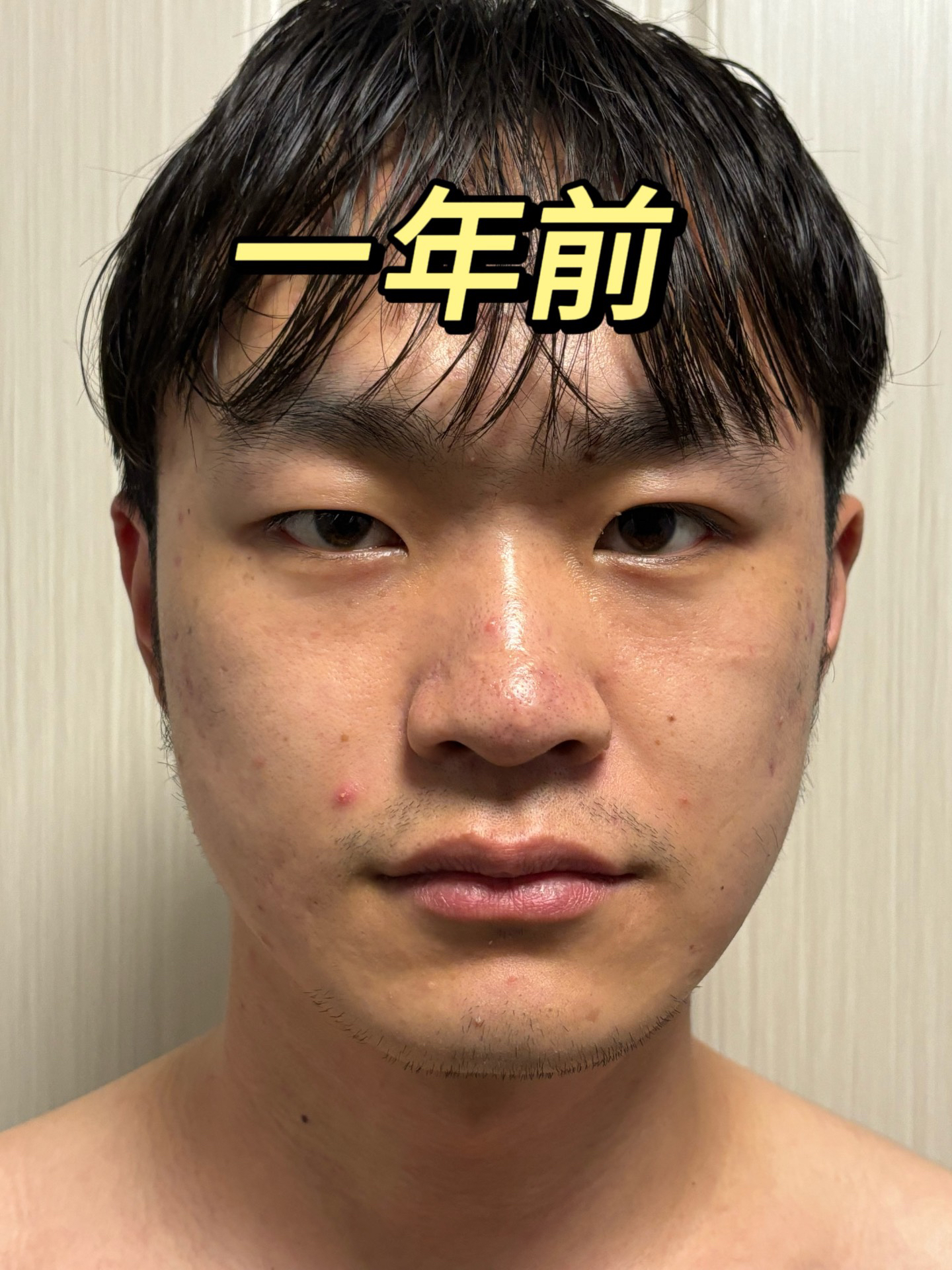 一年前vs一年后皮肤变化真的好大呀
