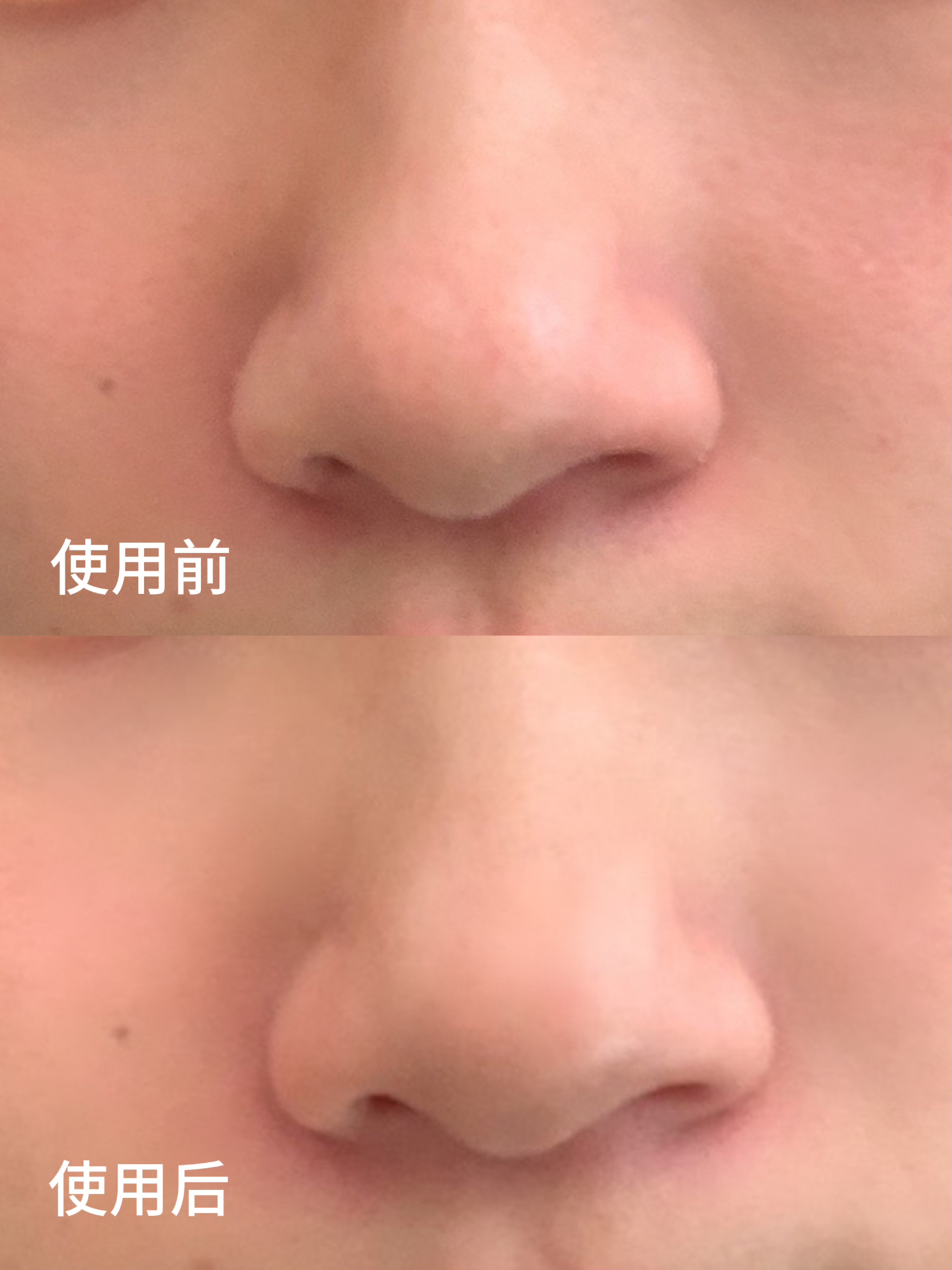 可以直接回购一辈子的收缩毛孔精华!