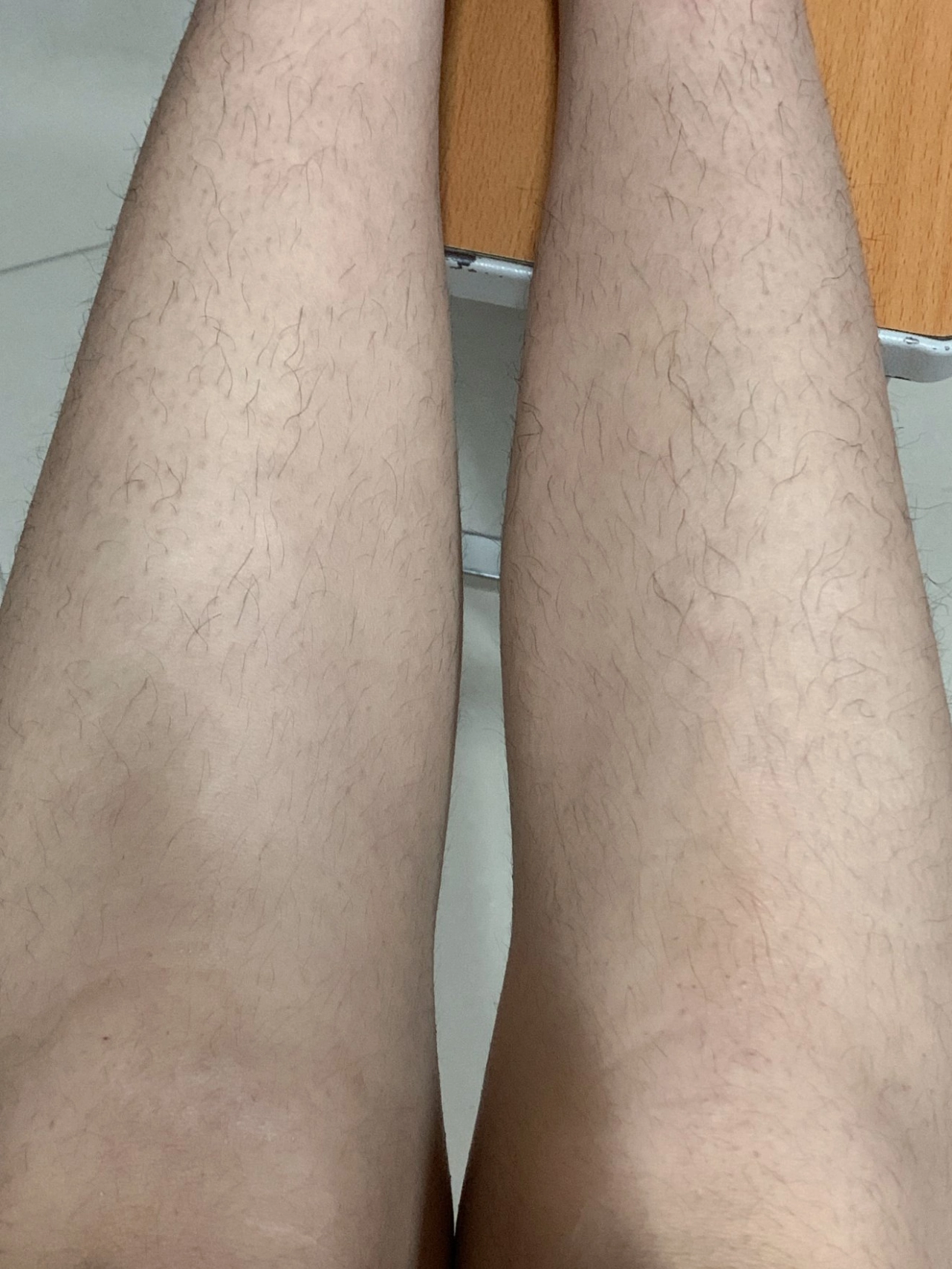 见过这么多腿毛的女生吗?