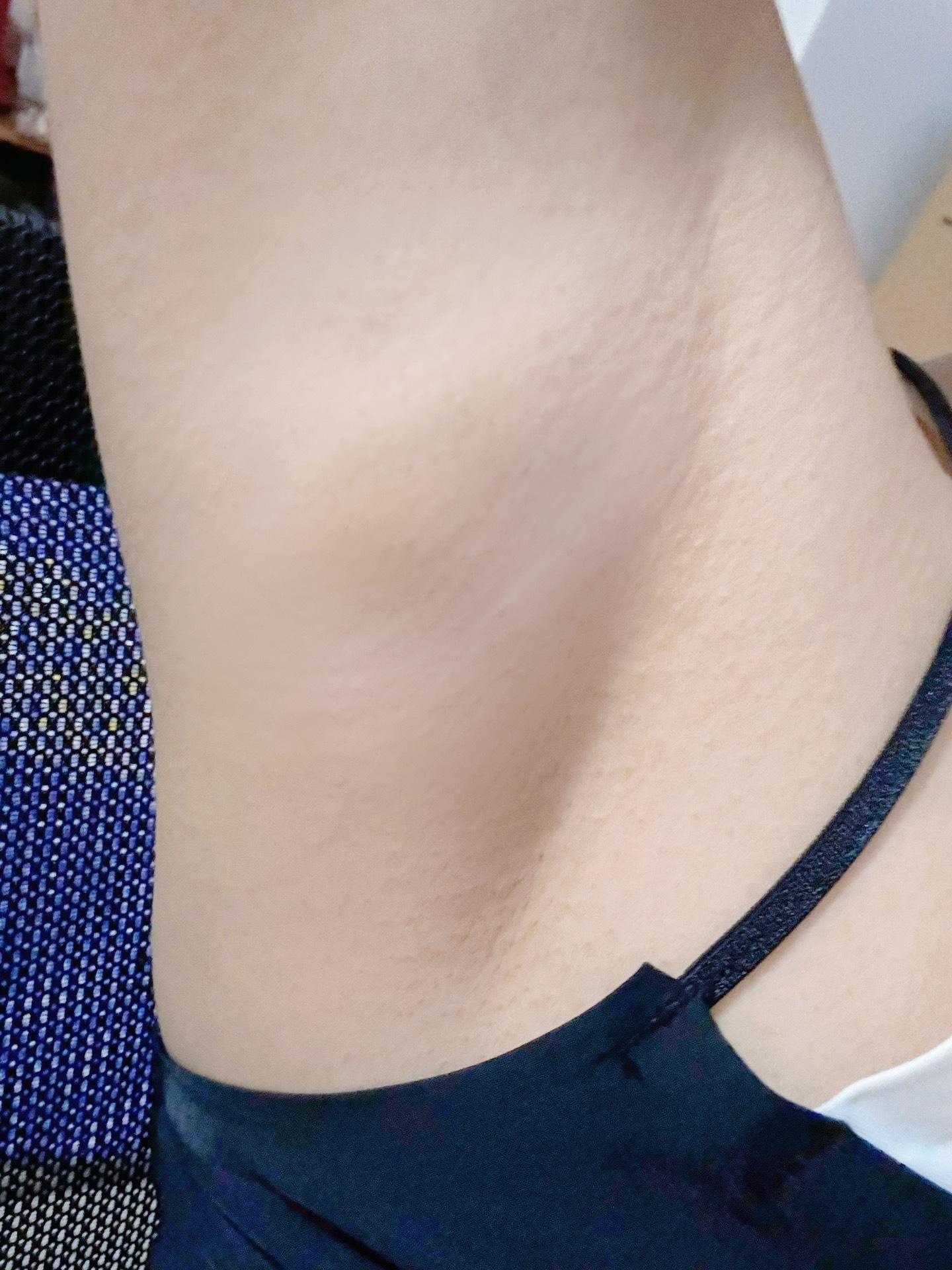 腋下终于干净啦