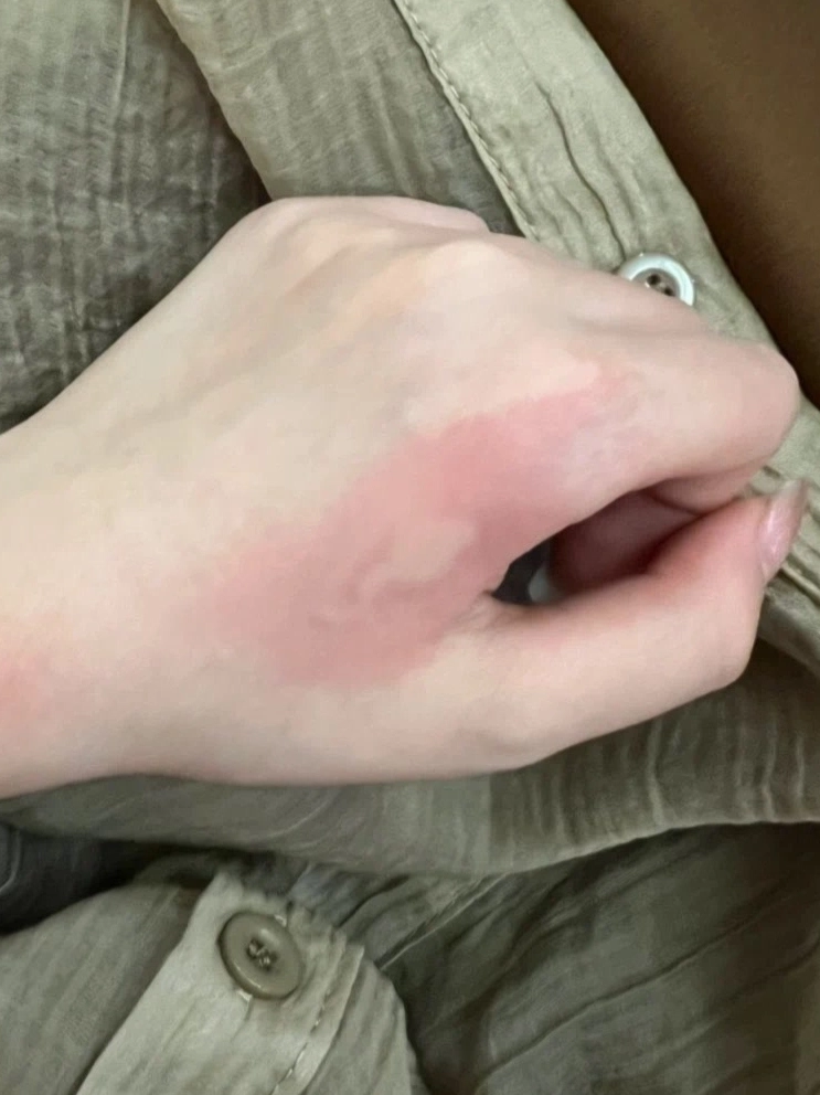 女人梦见自己手背被蛇咬了（女人梦见被蛇咬手背和背上是怎么回事） 女人梦见本身
手背被蛇咬了（女人梦见被蛇咬手背和背上是怎么回事） 卜算大全