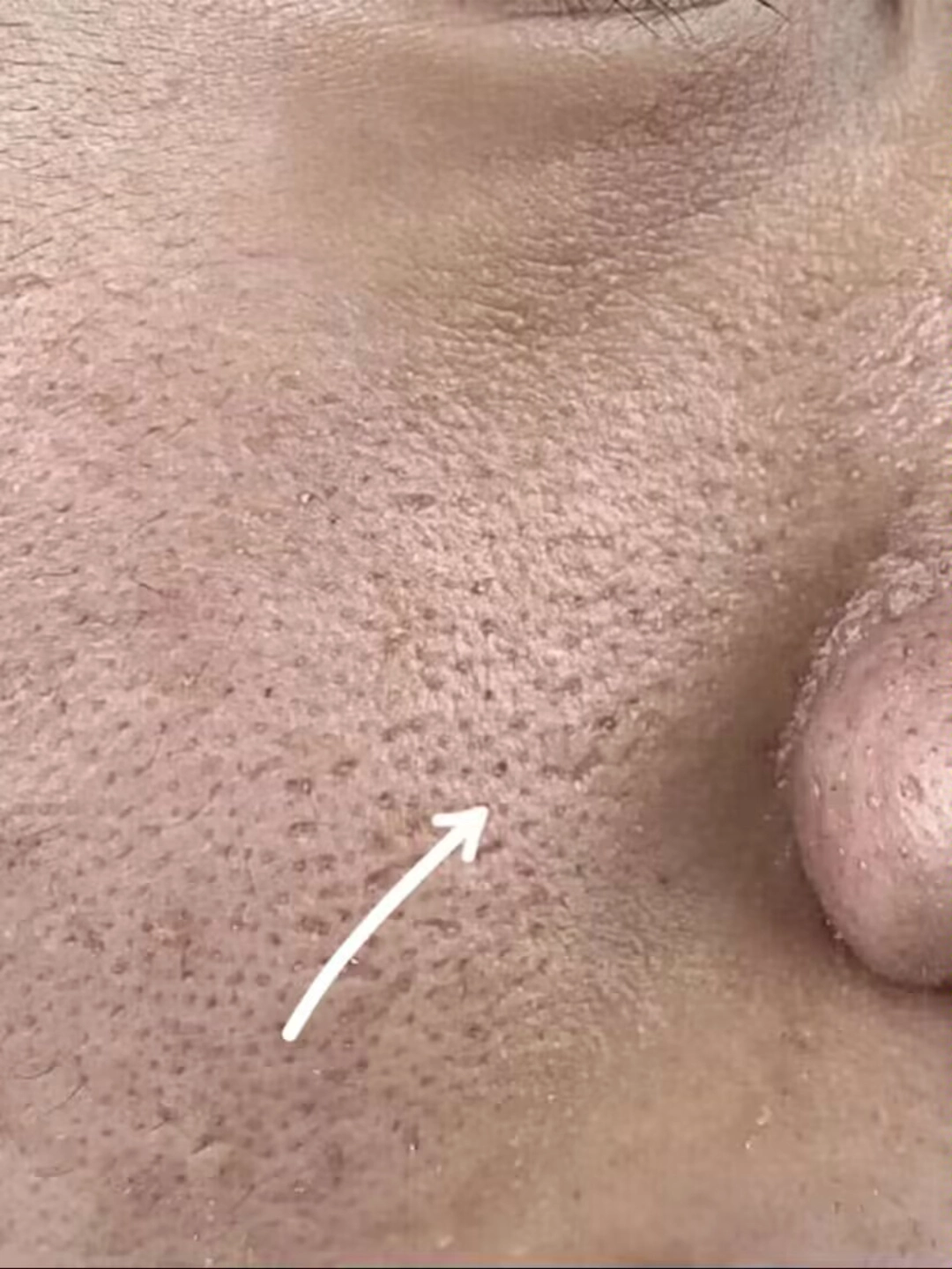 看不到大毛孔这张脸得有多帅