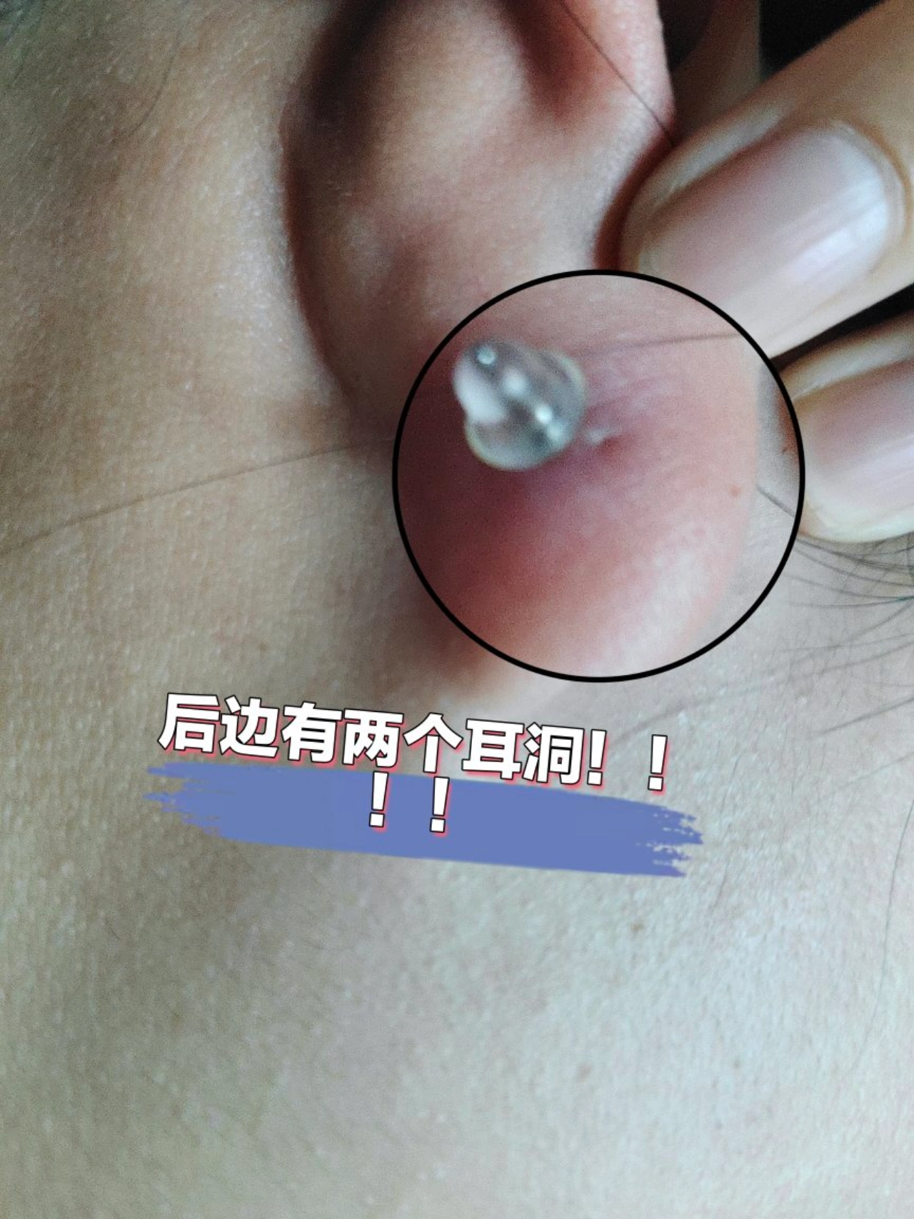 呆…jio卜