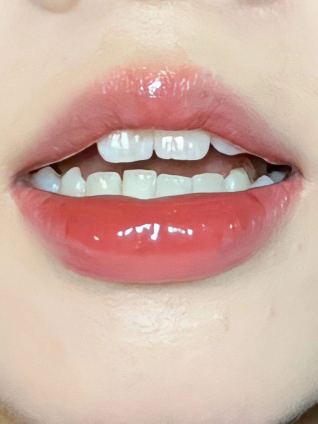 都去用!牙齿白了好看不止一点!