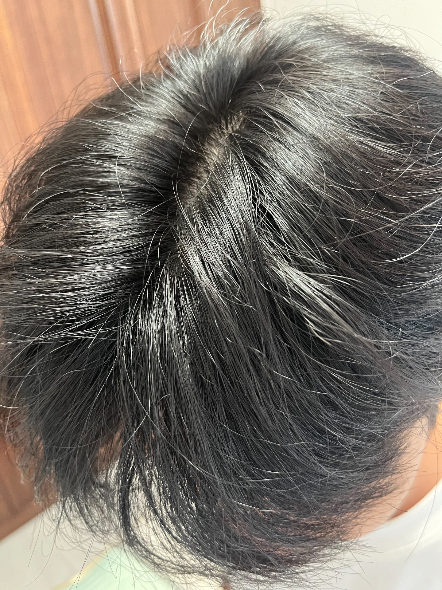 是什么让我稀疏的头发变得如此优越?