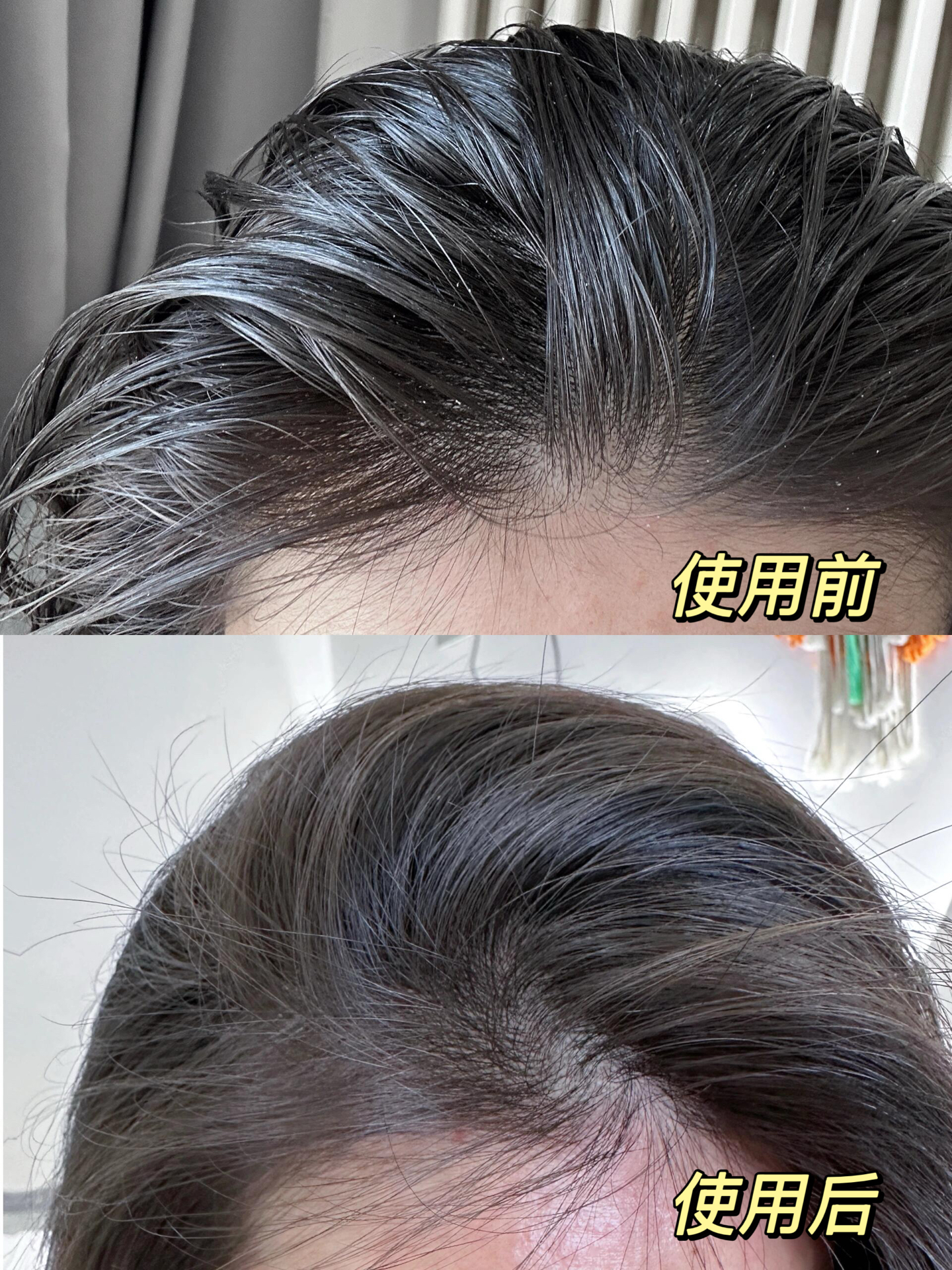 你们头发爱出油的人嘴是真严啊