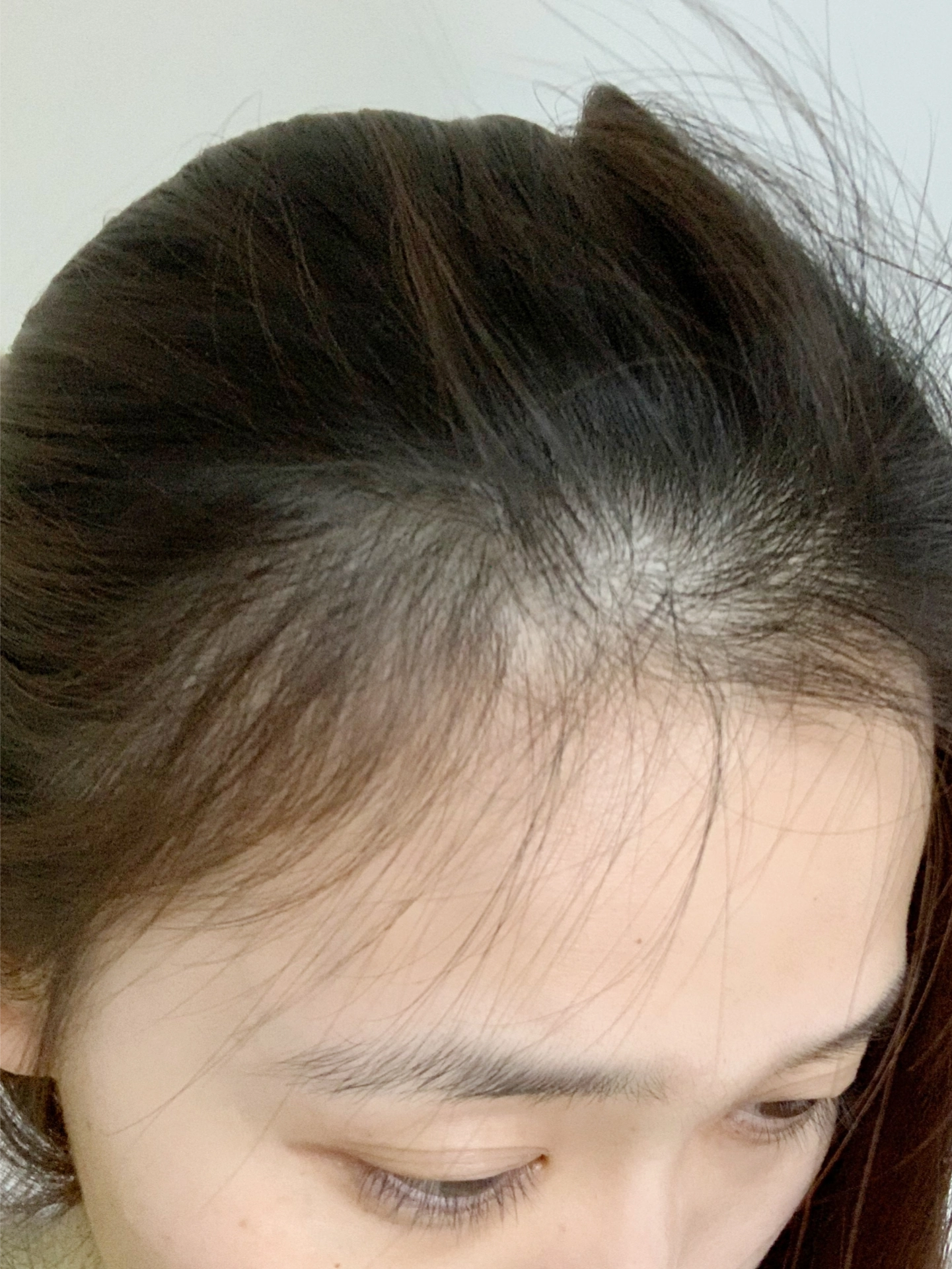 笑发财!是谁的发际线炸毛啦