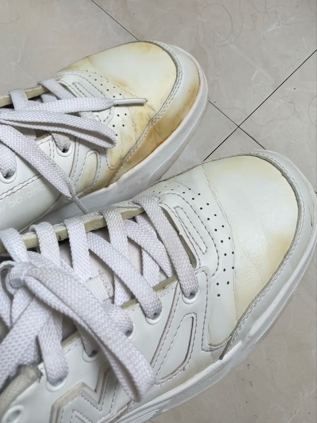 为什么鞋子洗了发黄怎么办为什么在线 为什么鞋子洗了发黄怎么办为什么在线