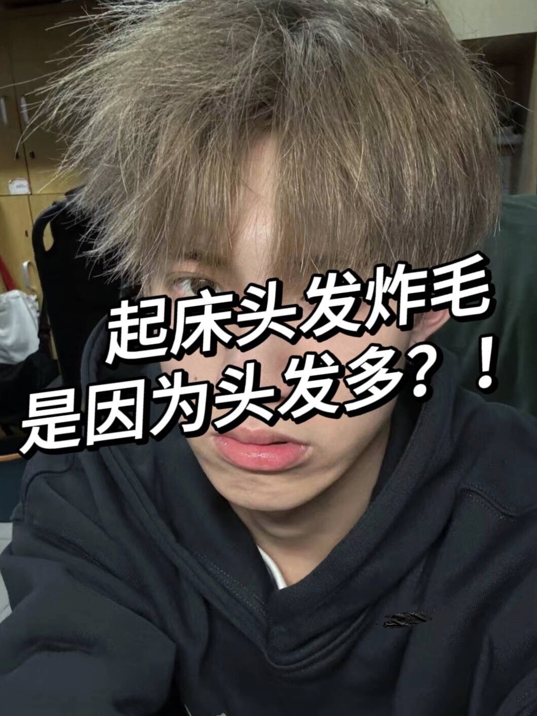 我服了!npy头发起床直接炸毛