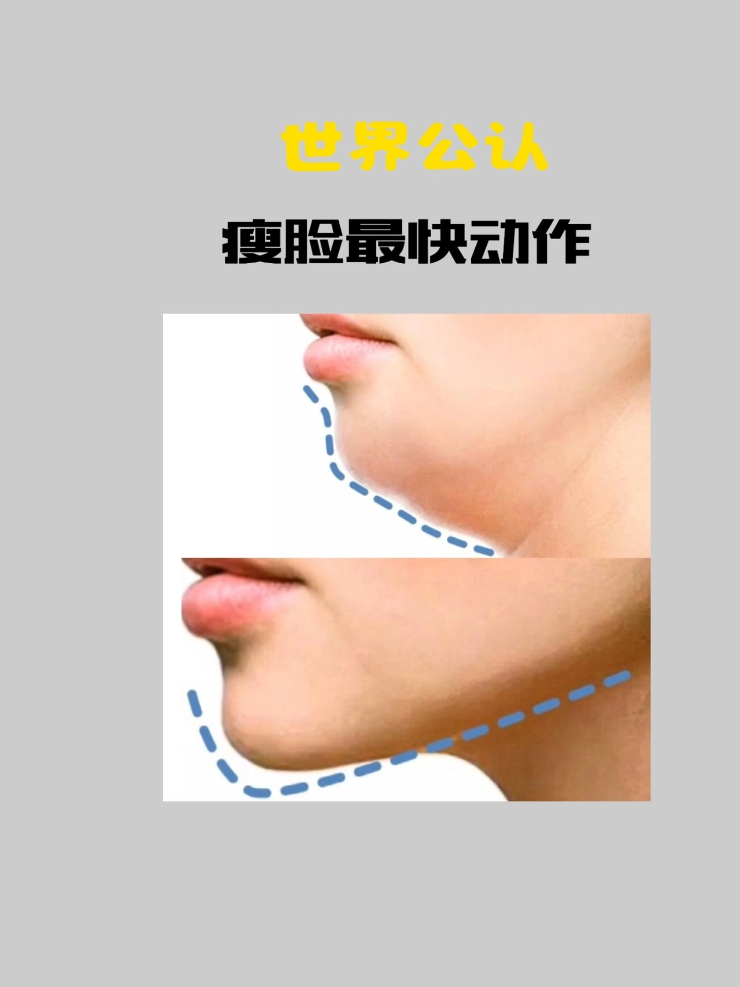 咬筷子提颧肌,提颧肌_大山谷图库